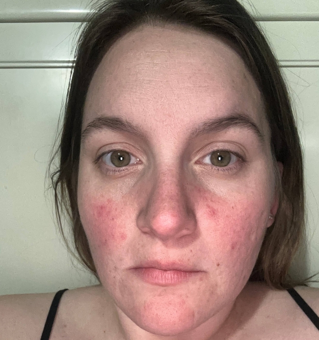 Ashley B., 34 Before