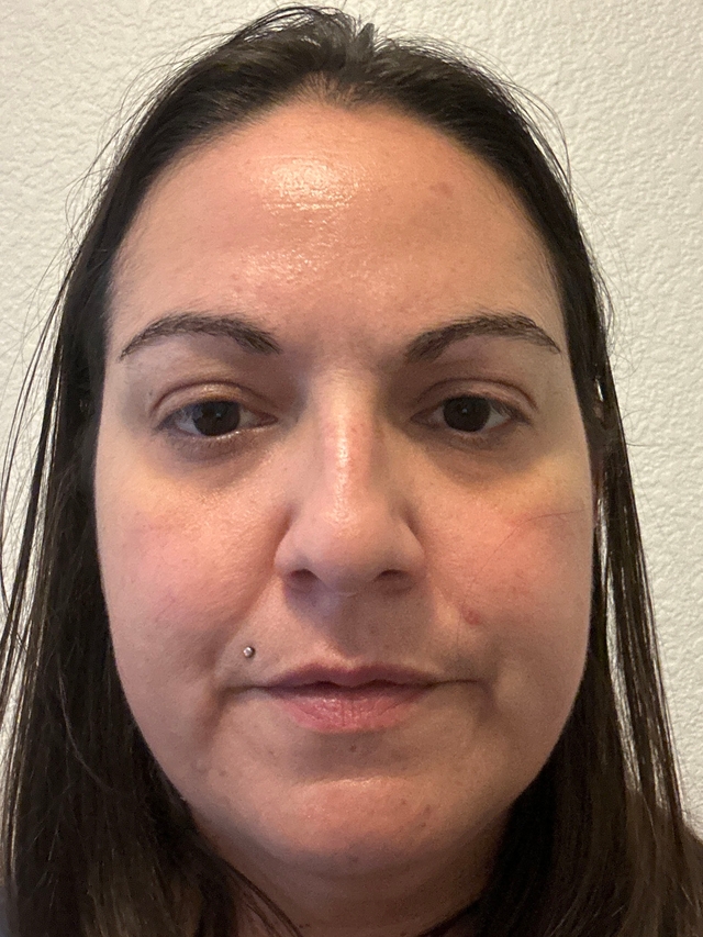 Ashley R., 40 Before
