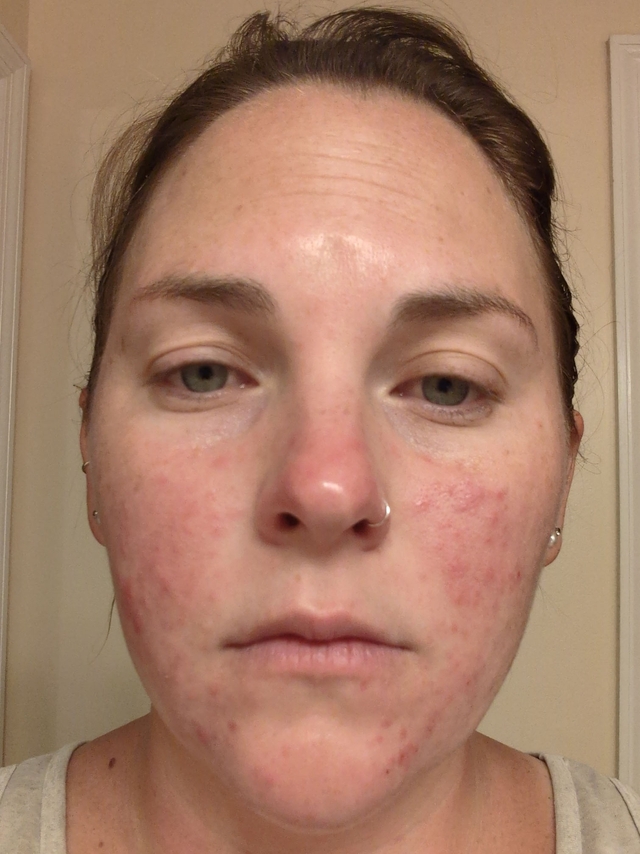 Caitlyn B., 31 Before