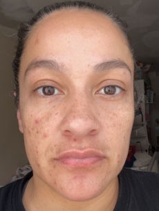 Nancy R., 41 Before