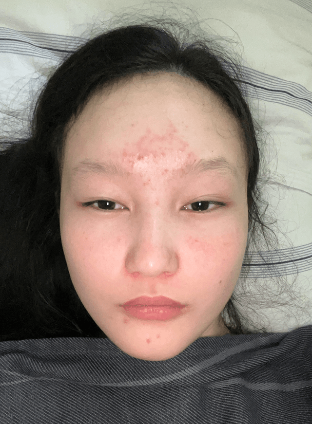 Erkai A., 19 Before