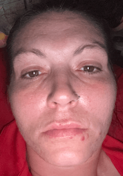 Ashley C., 36 Before