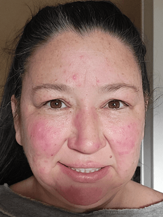 Beth S., 36-50 Before