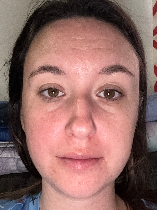 Kara K., 31 Before