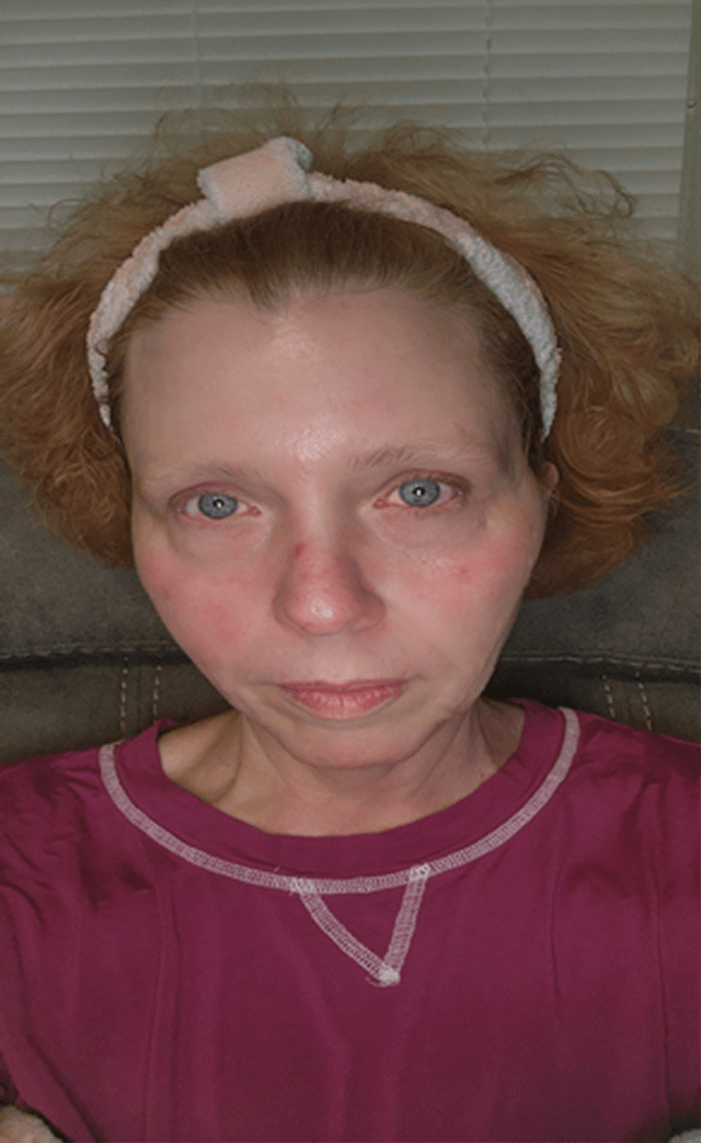 Jenny W., 56 Before