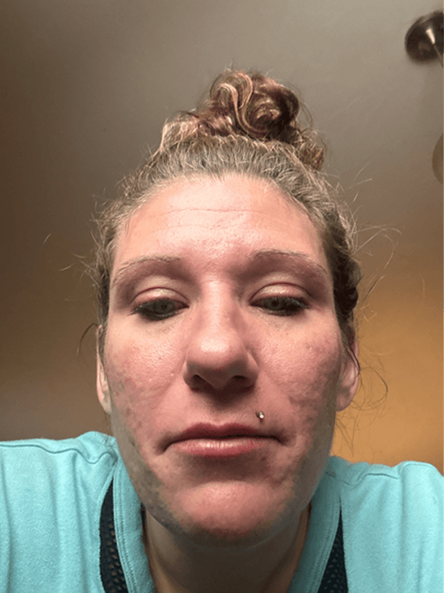 Denise J., 40 Before