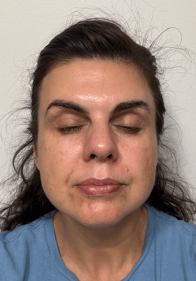 Halyna M., 46 Before