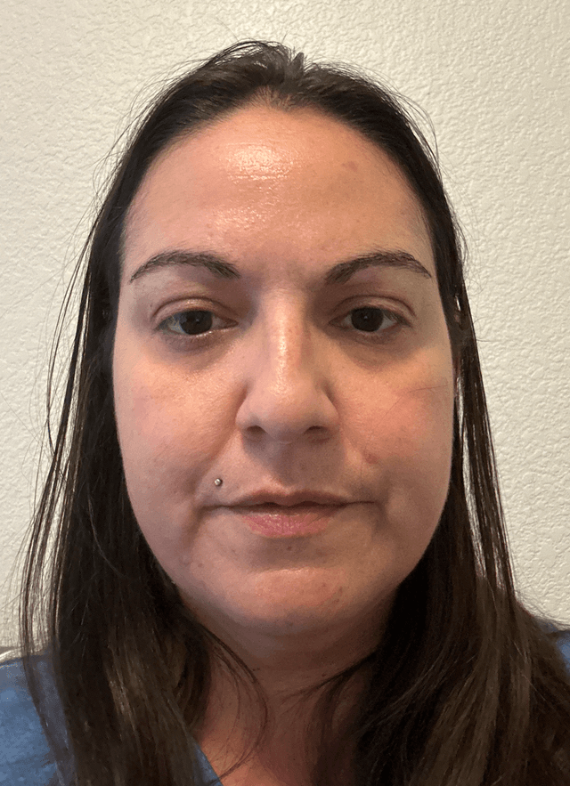 Ashley R., 40 Before