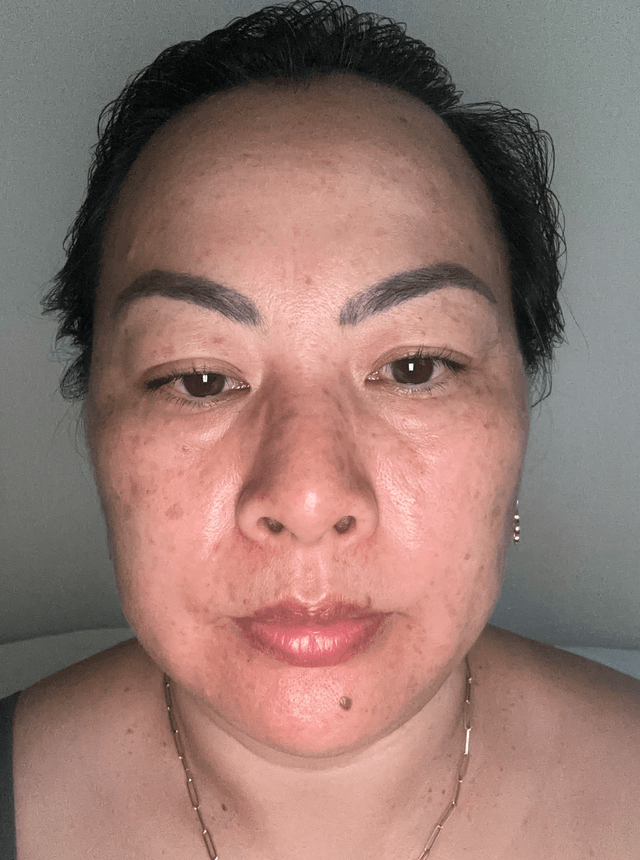 Abbie T., 48 Before