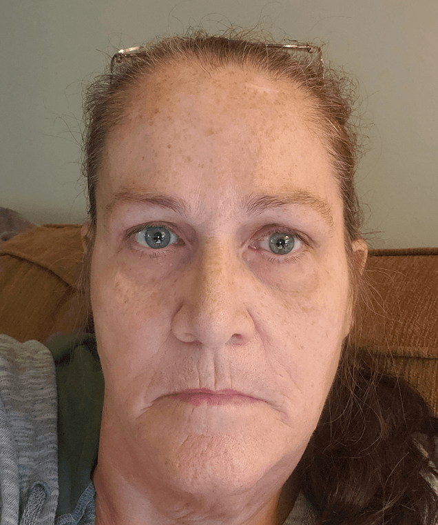 Barbara W., 58 Before