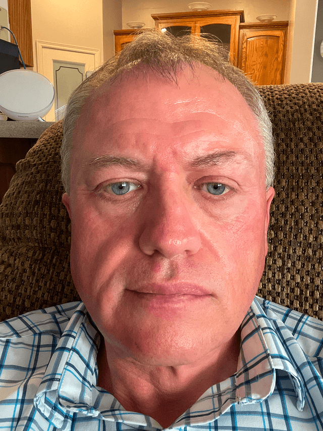 Michael A., 51 Before