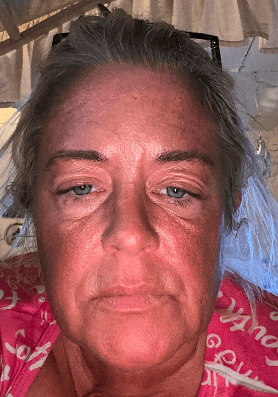 Christina C., 52 Before