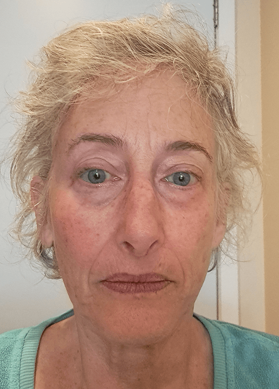Julie B., 63 Before