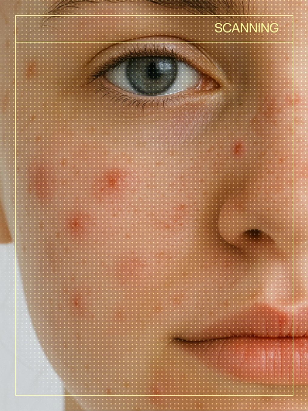 Targets the root cause of acne
