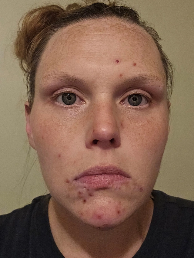 Alyssa C., 34 Before