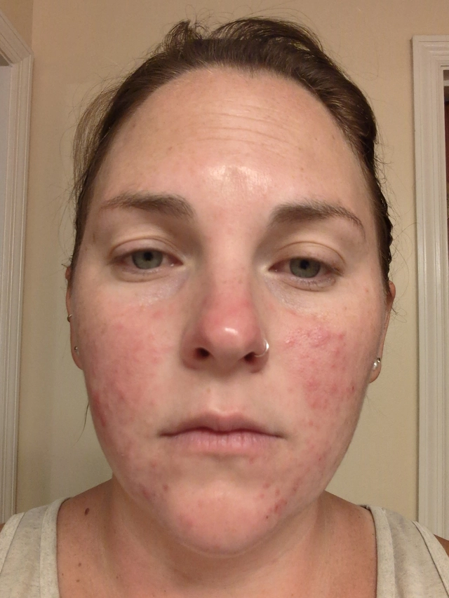 Caitlyn B., 31 Before