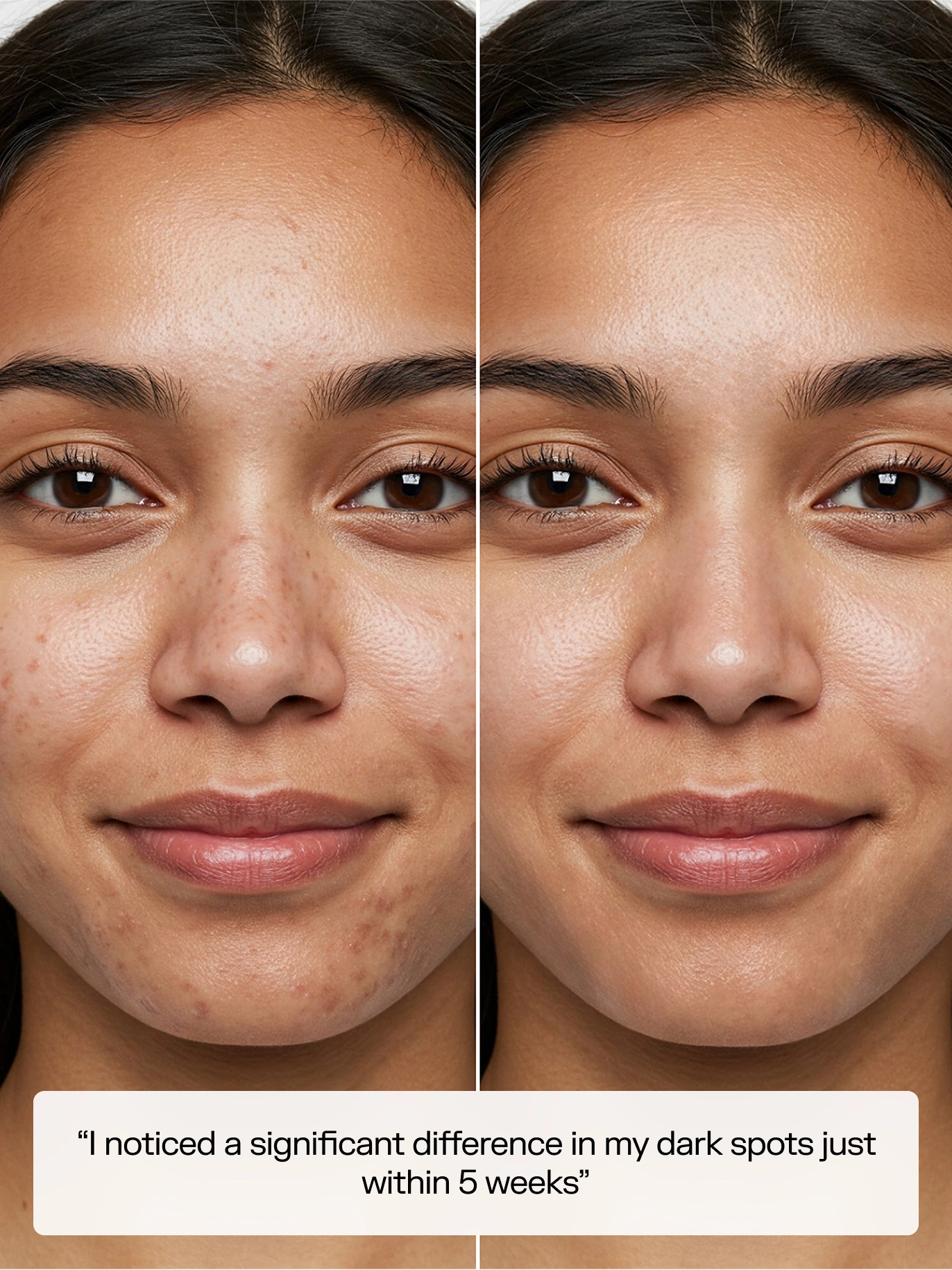 Clear Skin, Guaranteed