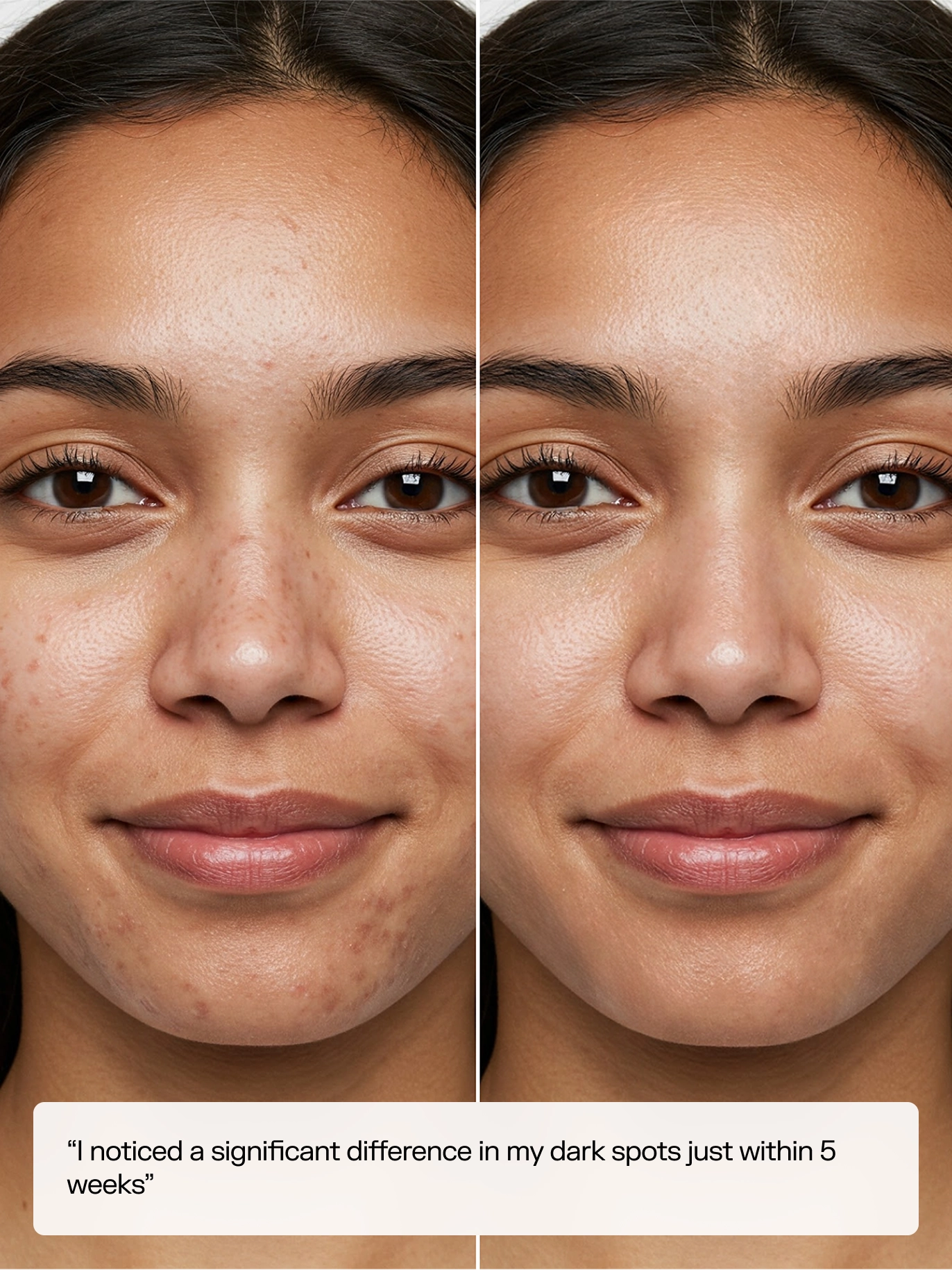 Clear Skin, Guaranteed