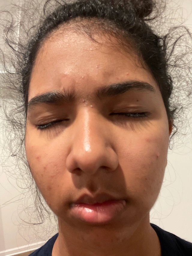 Kayla G.
Before