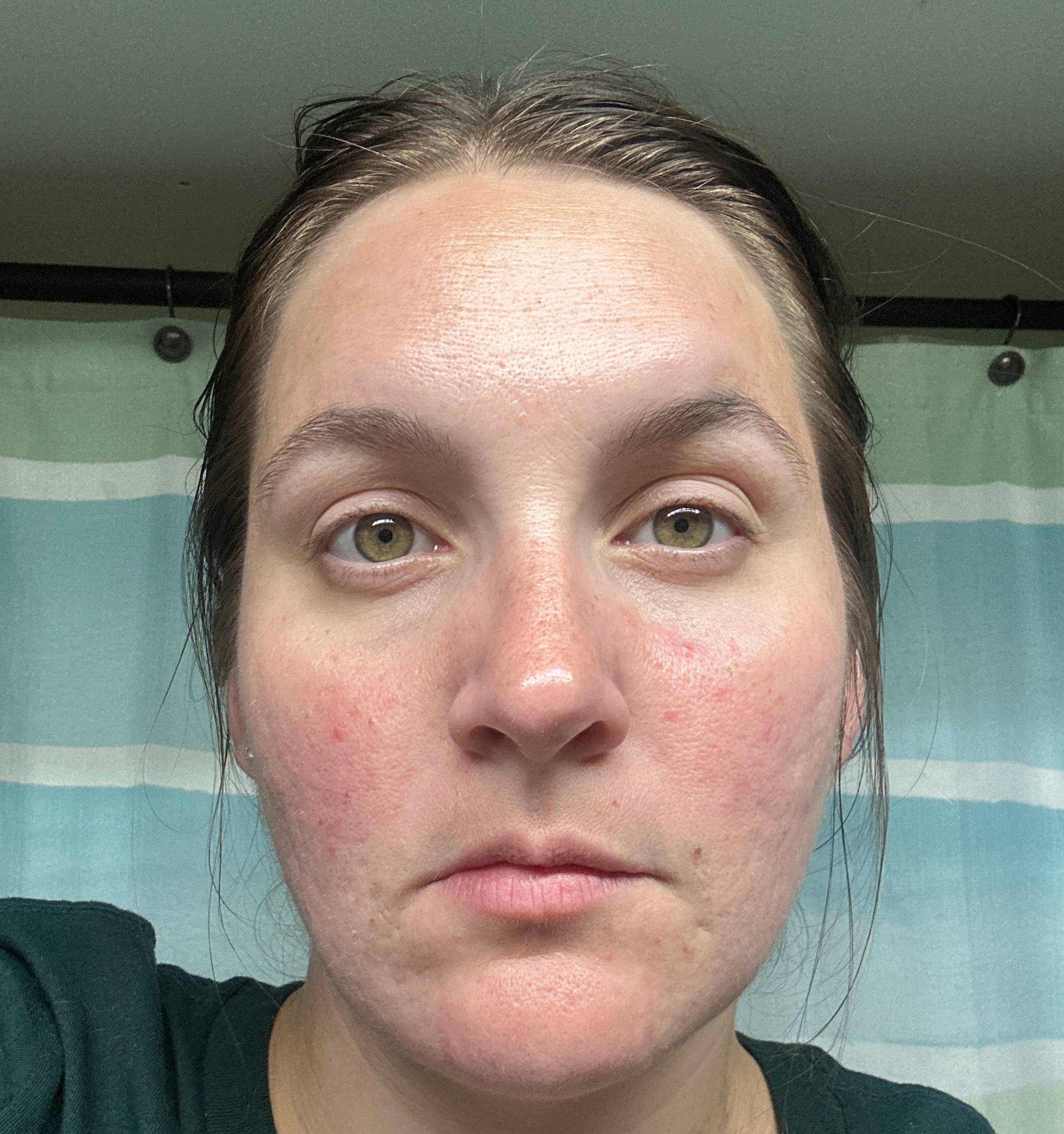 Ashley B., 34 After