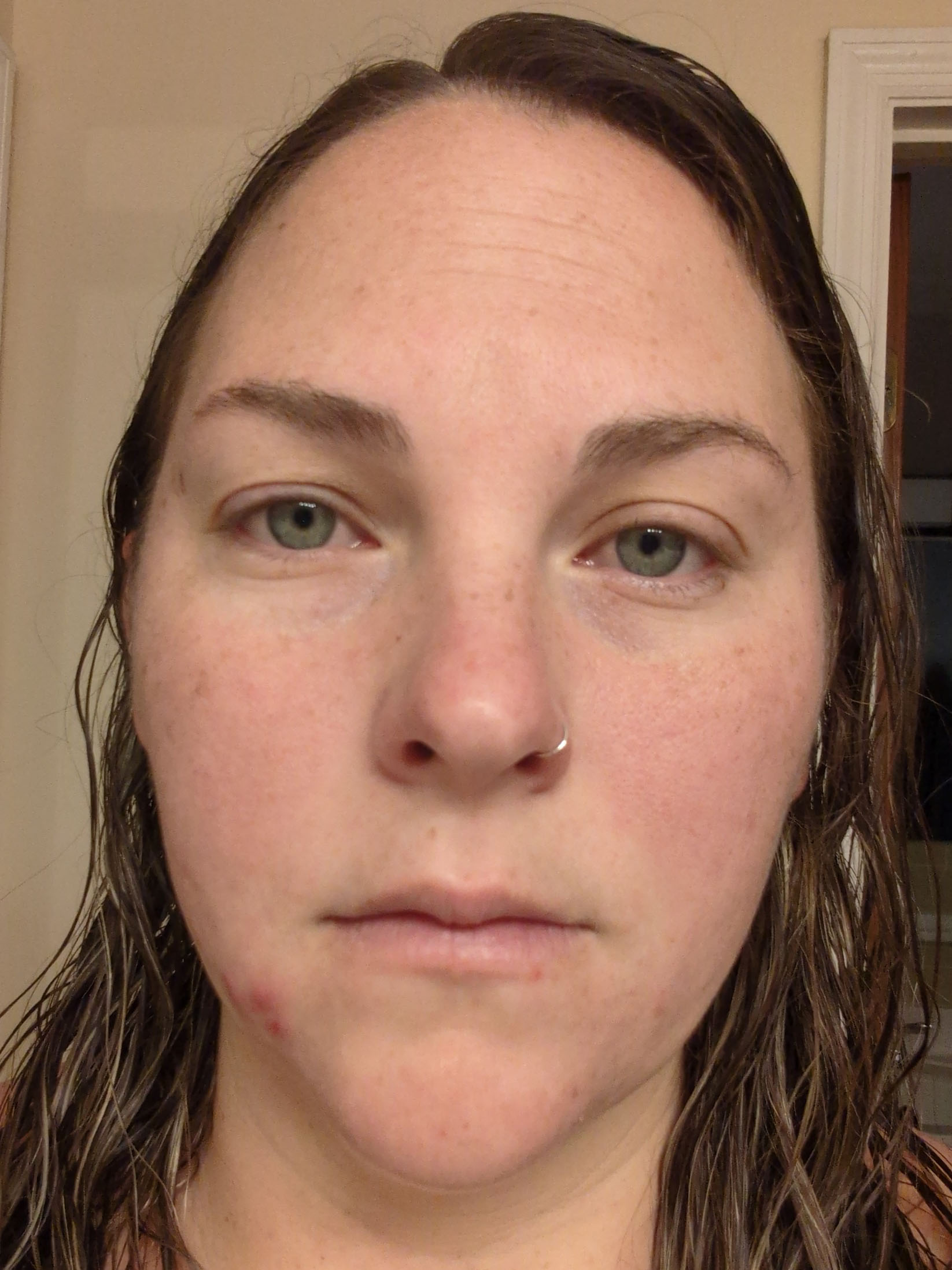 Caitlyn B., 31 After