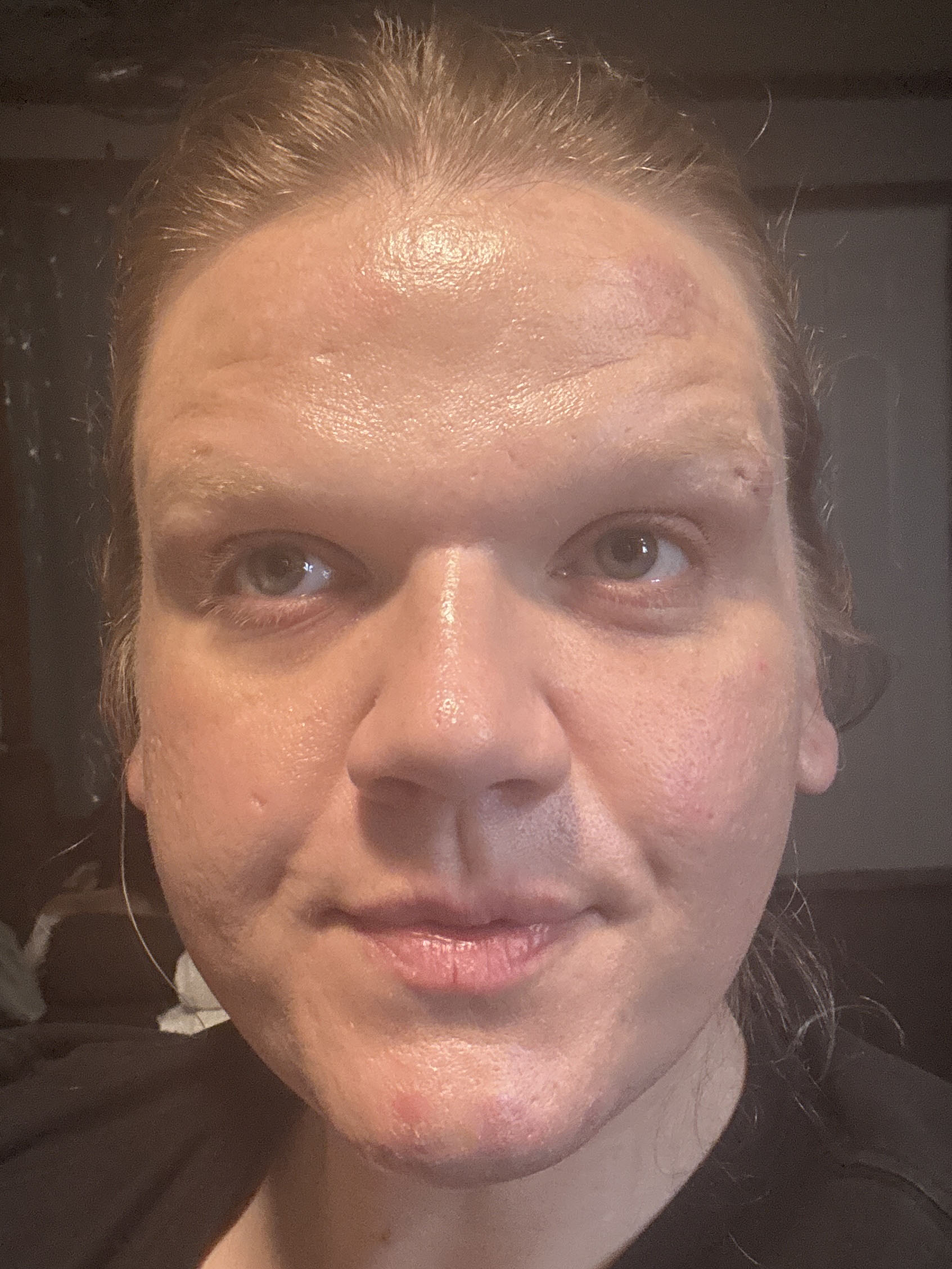 Dami P., 40 After