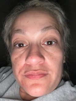 Nancy R., 41 After
